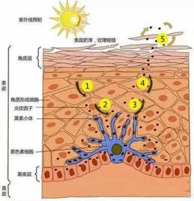 led灯辐射皮肤痘痘_led灯对人体辐射大吗-第3张图片-DAWOOD LED频闪灯