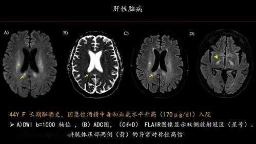 1670镜头拍桃花_湖北免疫性不孕医院-第1张图片-DAWOOD LED频闪灯