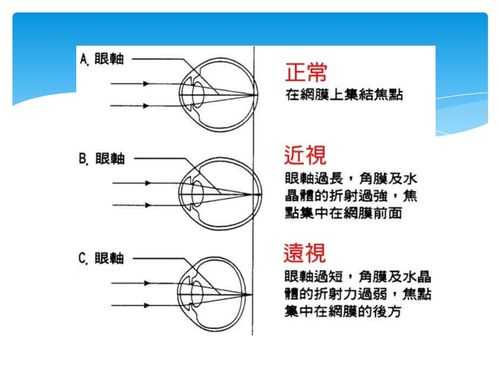 STF散景镜头（散景滤镜原理）-第3张图片-DAWOOD LED频闪灯